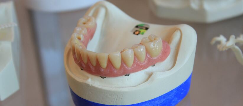 Рассказываем о новых методах имплантации зубов