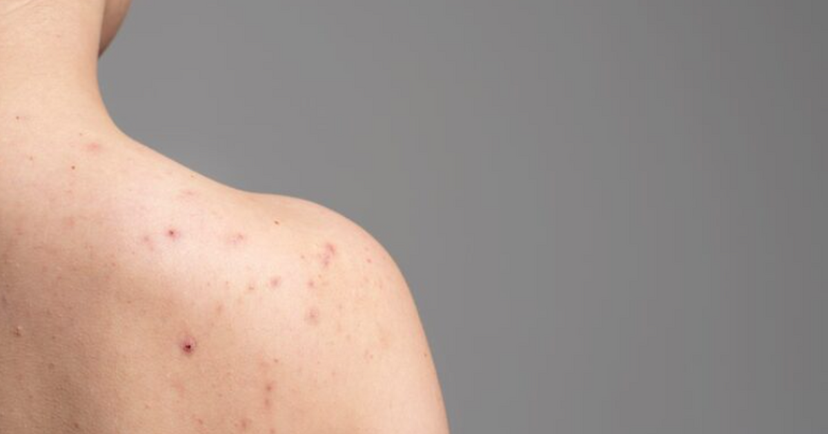 22-летняя студентка из США списывала зудящую сы...