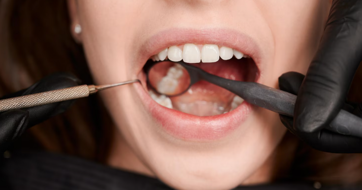 Исследователи выяснили, что употребление продук...