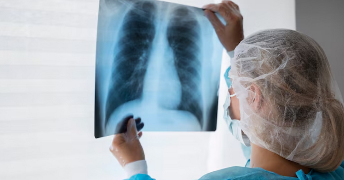 Учёные ПетрГУ совместно с турецкими коллегами р...