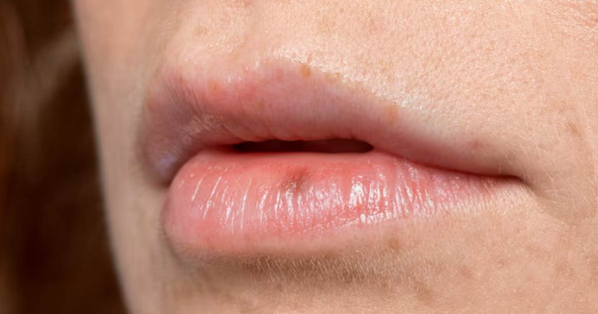 Ученые: вирус герпеса HHV-6 эволюционировал вместе с человеком более 2800 лет Международная группа исследователей из Венского...