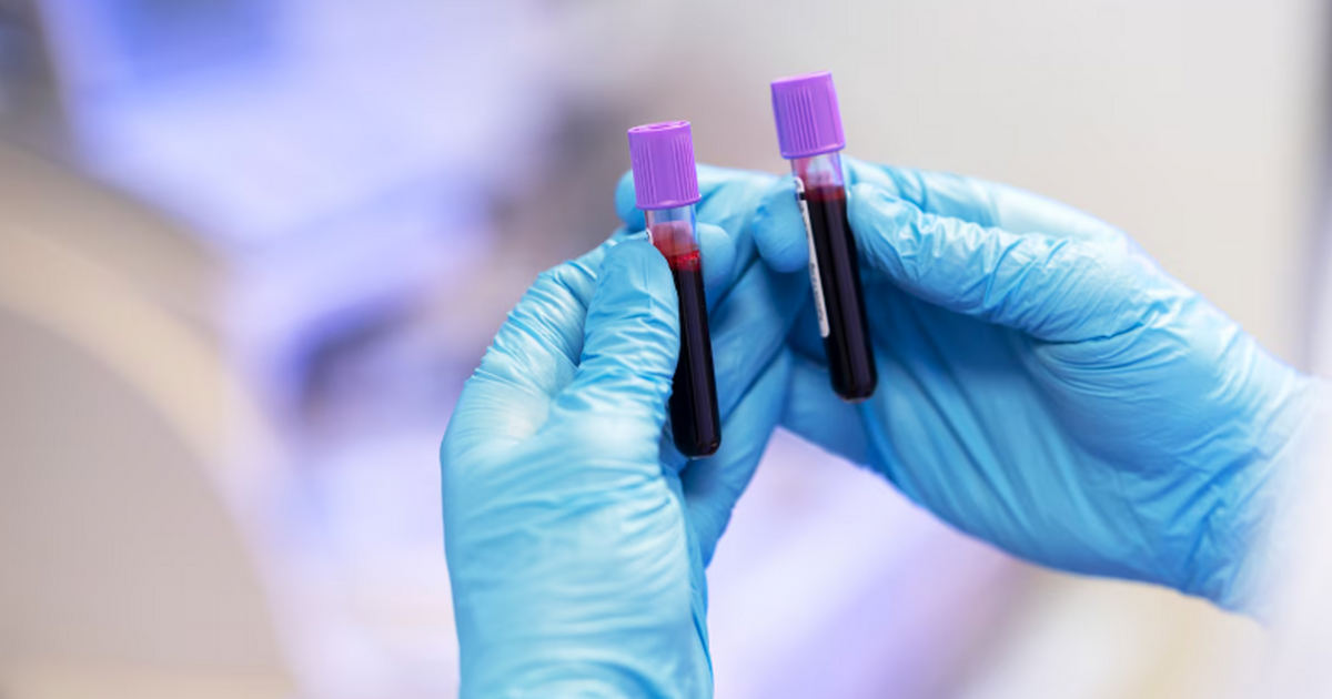 Хроническая усталость, когнитивные нарушения и ...