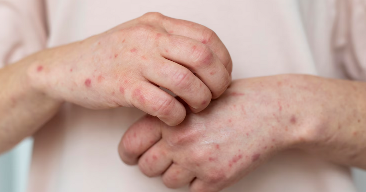 Исследование 2,8 млн детей показало, что пищева...