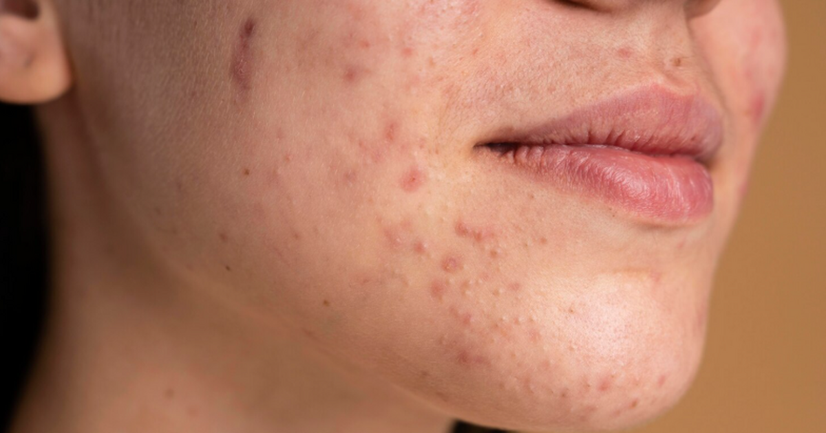 Геномный анализ показывает, что воспаление пери...