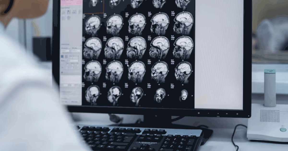 Исследование в Cell Death and Disease показало,...
