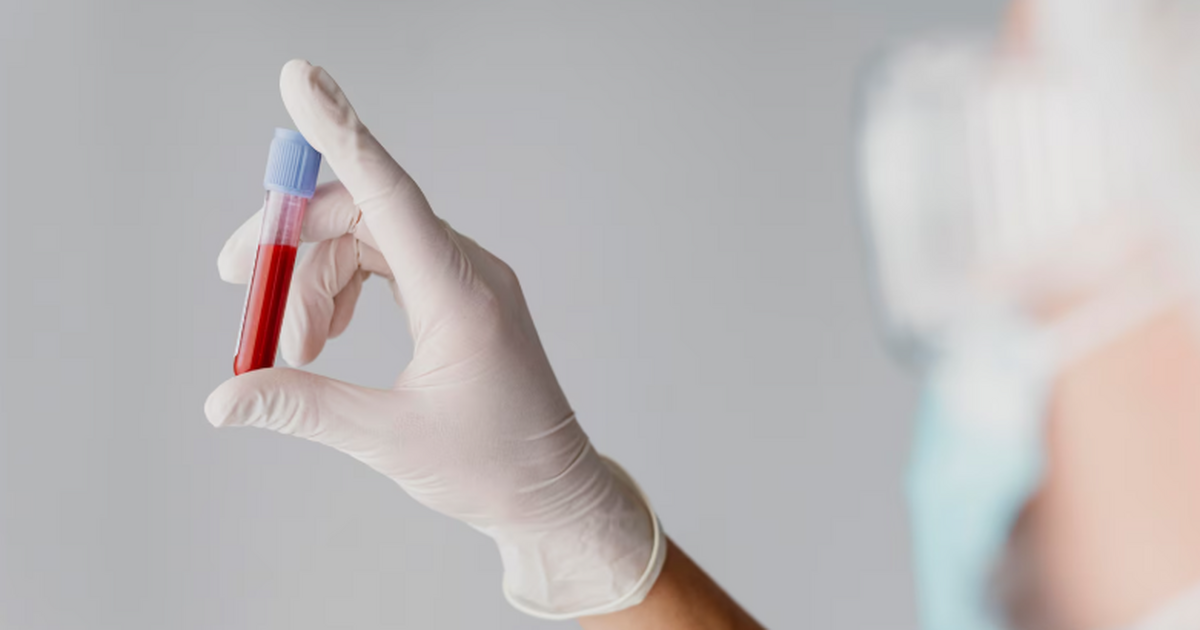 Учёные нашли в крови пациентов с «долгим COVID» необычные микросгустки Медики обнаружили в крови людей с длительным те...