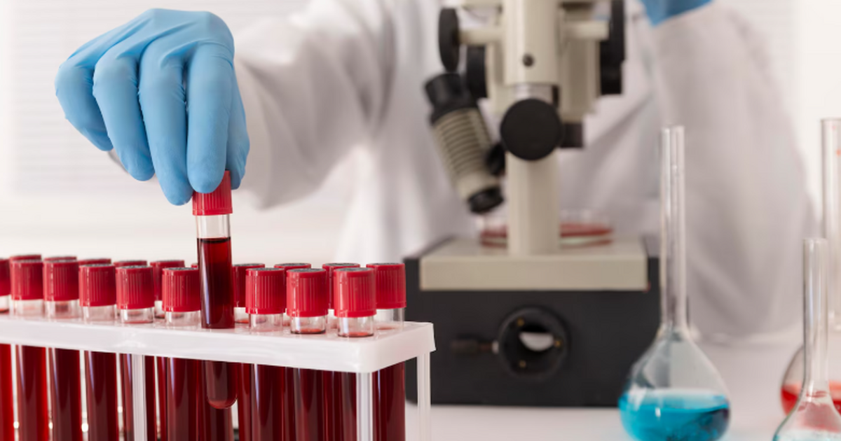 Baza: локальные вспышки ВИЧ фиксируют в Хакасии, Коми и Иркутской области В ряде регионов России отмечают локальные вспыш...