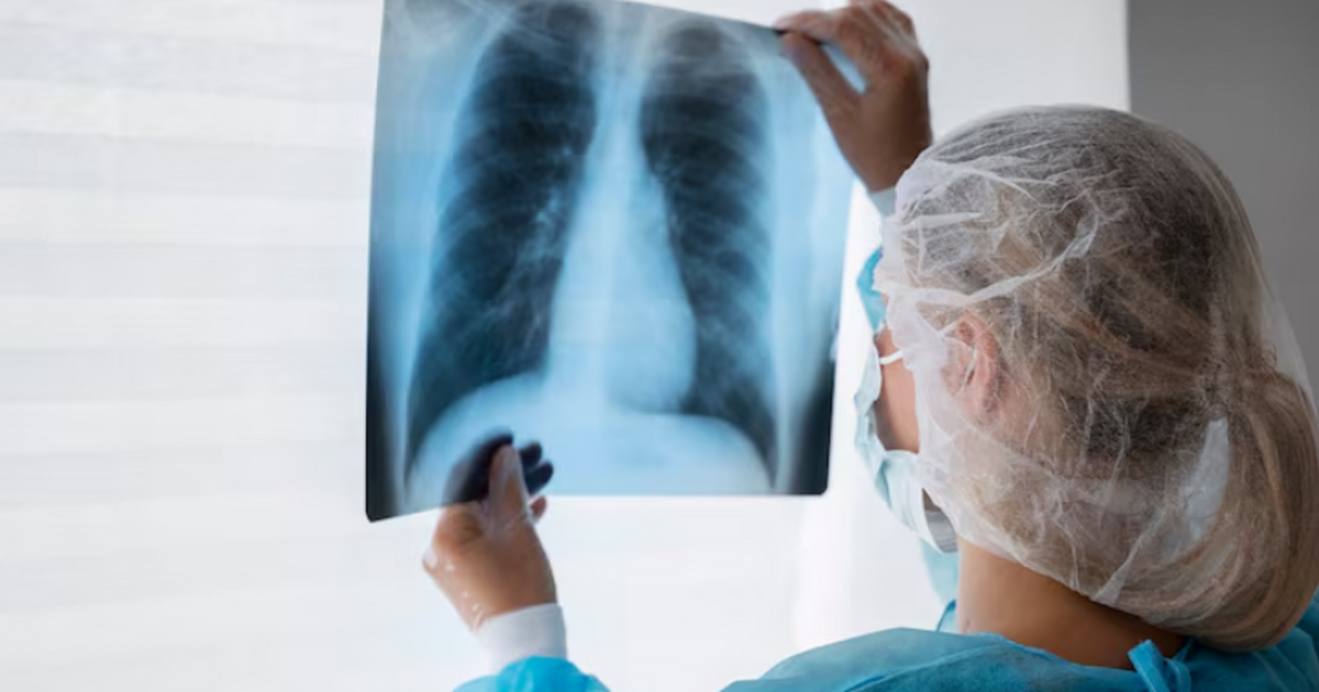 У части пациентов с аденокарциномой лёгких — са...