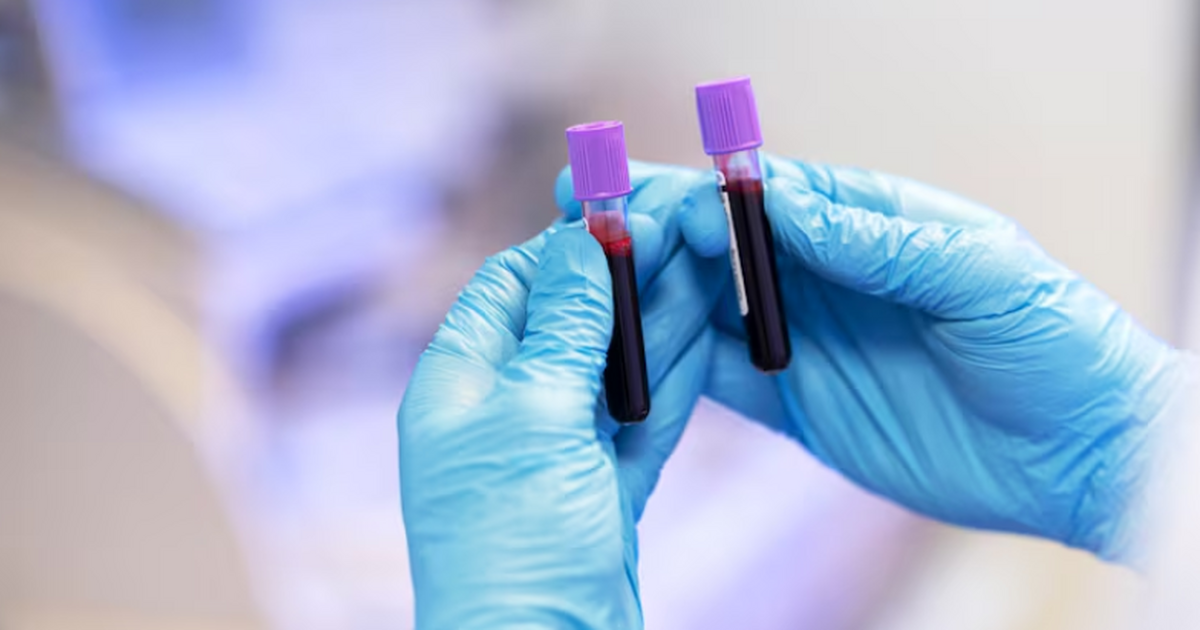 Ученые выявили набор белков крови, повышенные у...