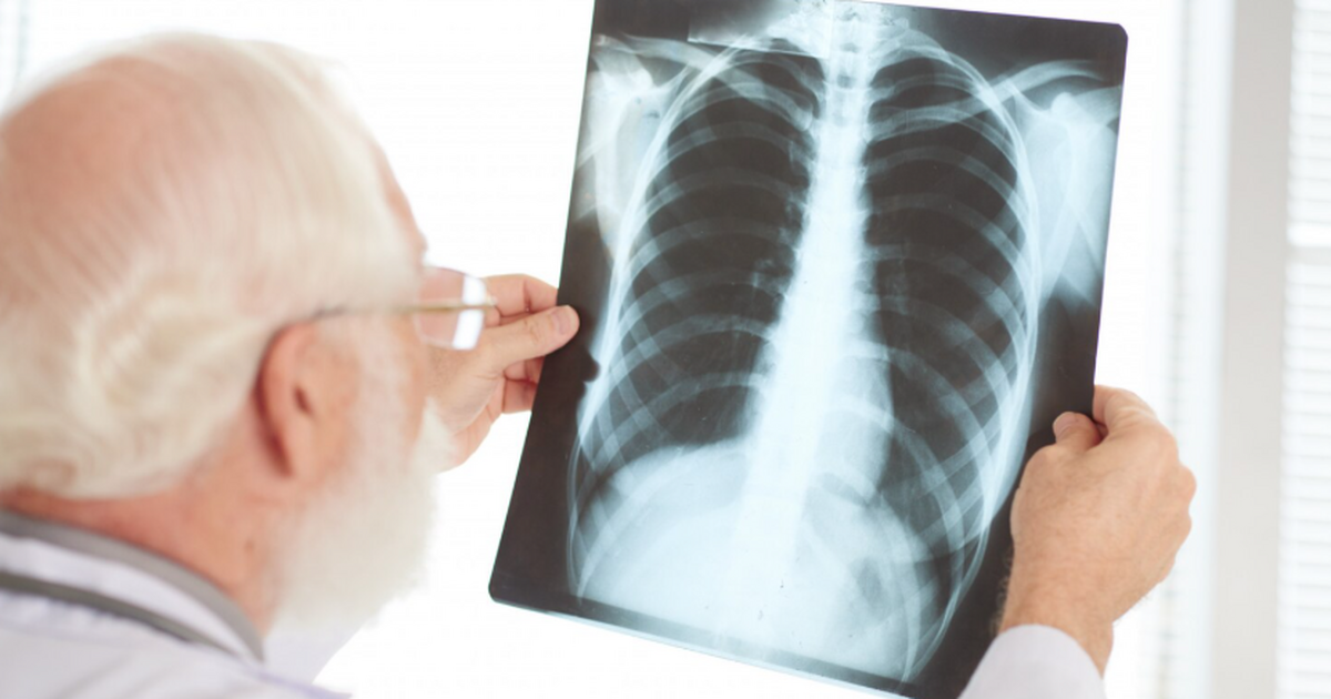 Исследование: ученые МГУ улучшили ИИ для точной диагностики туберкулеза Ученые представили новый метод, который позволя...