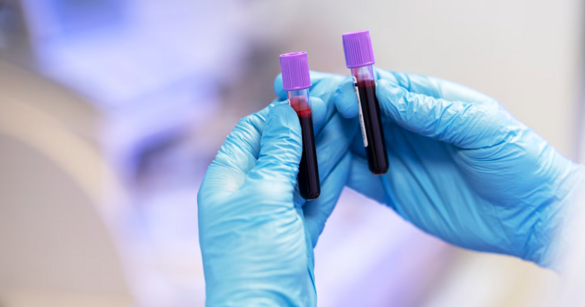 The Conversation: разработан метод оценки риска ранней смерти по анализу крови Ученые предложили способ оценивать риск ранней ...