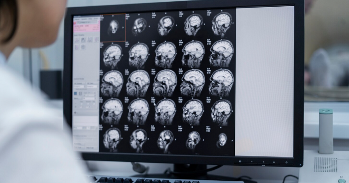 Ученые выявили уникальный электрический сигнал ...