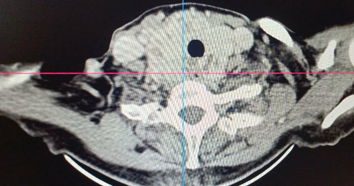 Он представлял угрозу для сердечно-сосудистой с...