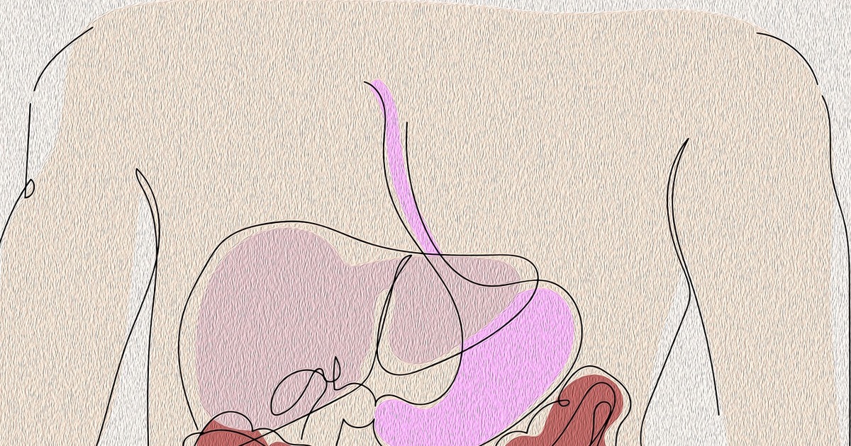 В исследовании приняли участие 633 пациента с а...