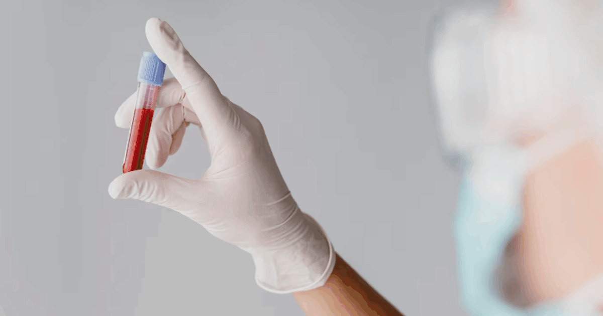 BMC Medicine: прошло исследование связи 3 группы крови с диабетом 2 типа В журнале BMC Medicine опубликована статья, в к...