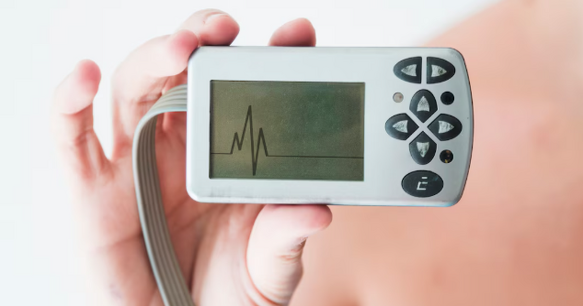 Российские учёные создали гибкие нанокомпозитные электроды для ЭКГ без геля Российские учёные разработали гибкие композитны...