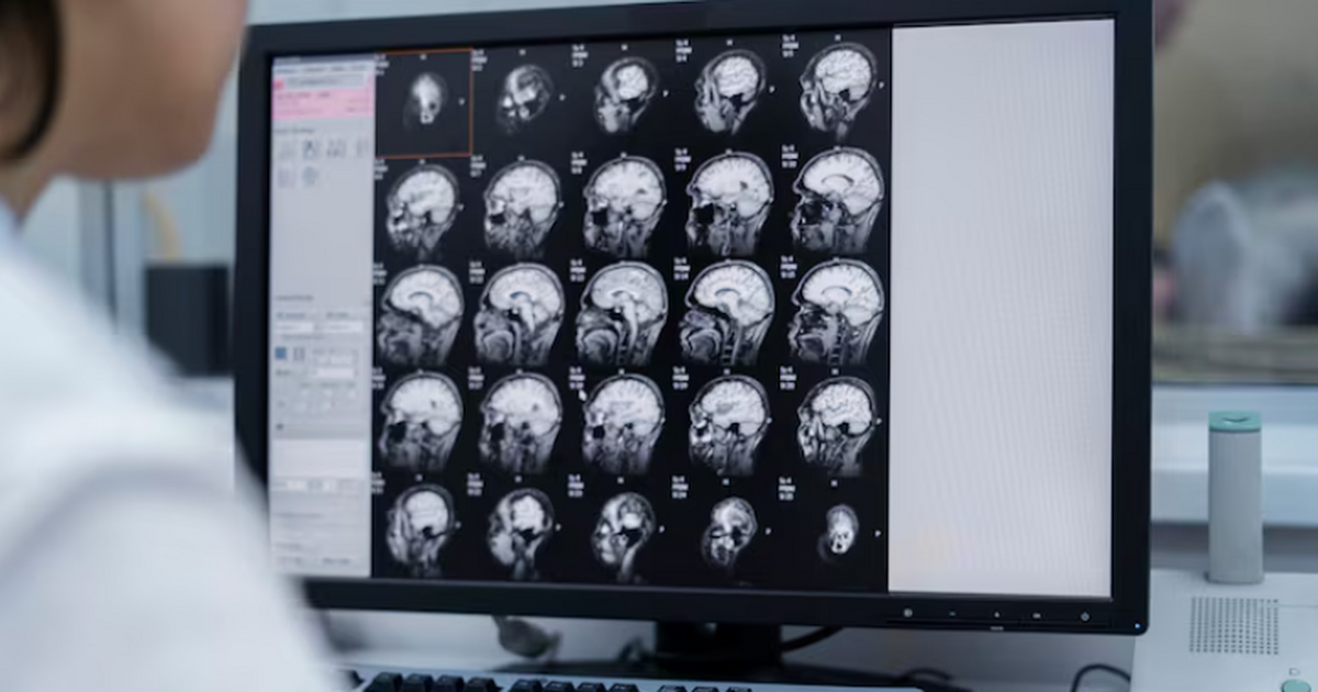 Исследователи из США показали, что коррекция ми...