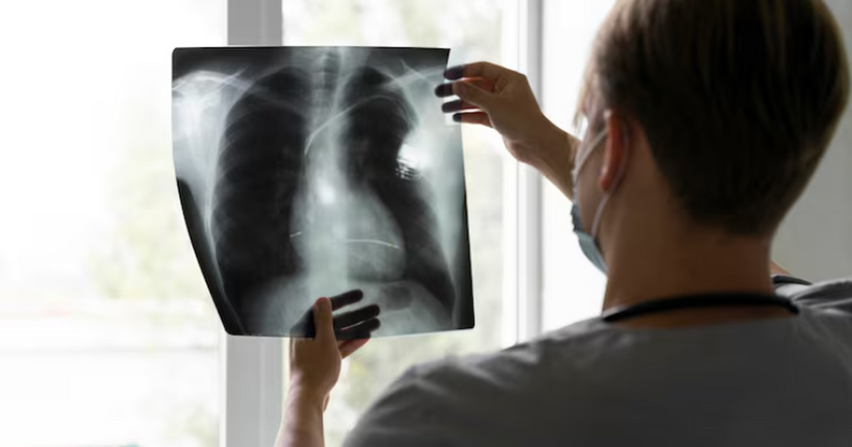 Медицинские исследования показывают, что вейпы ...