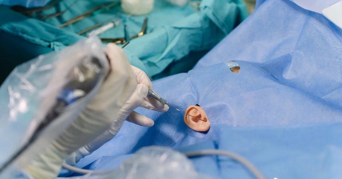 Ученые начали проводить операции по восстановле...