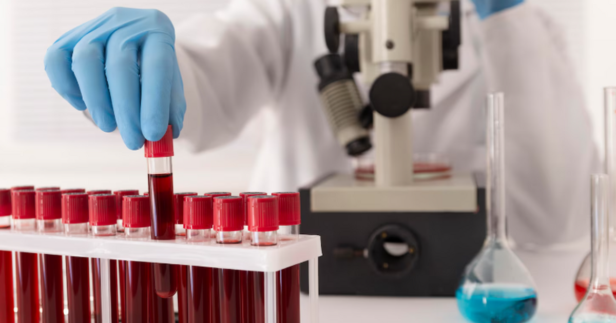 Гематолог Паровичникова назвала потливость признаком болезней крови Гематолог Минздрава РФ в интервью РИА Новости н...