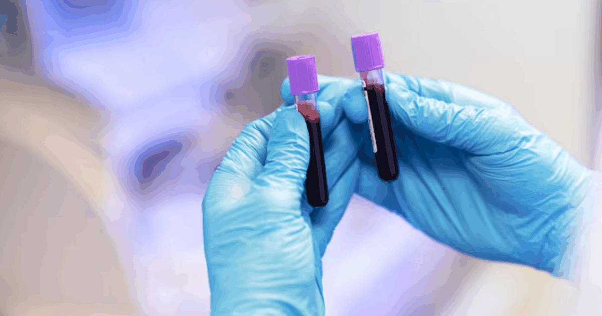 BMC Medicine: названа группа крови, повышающая риск диабета 2 типа Метаанализ в BMC Medicine показал, что носители...