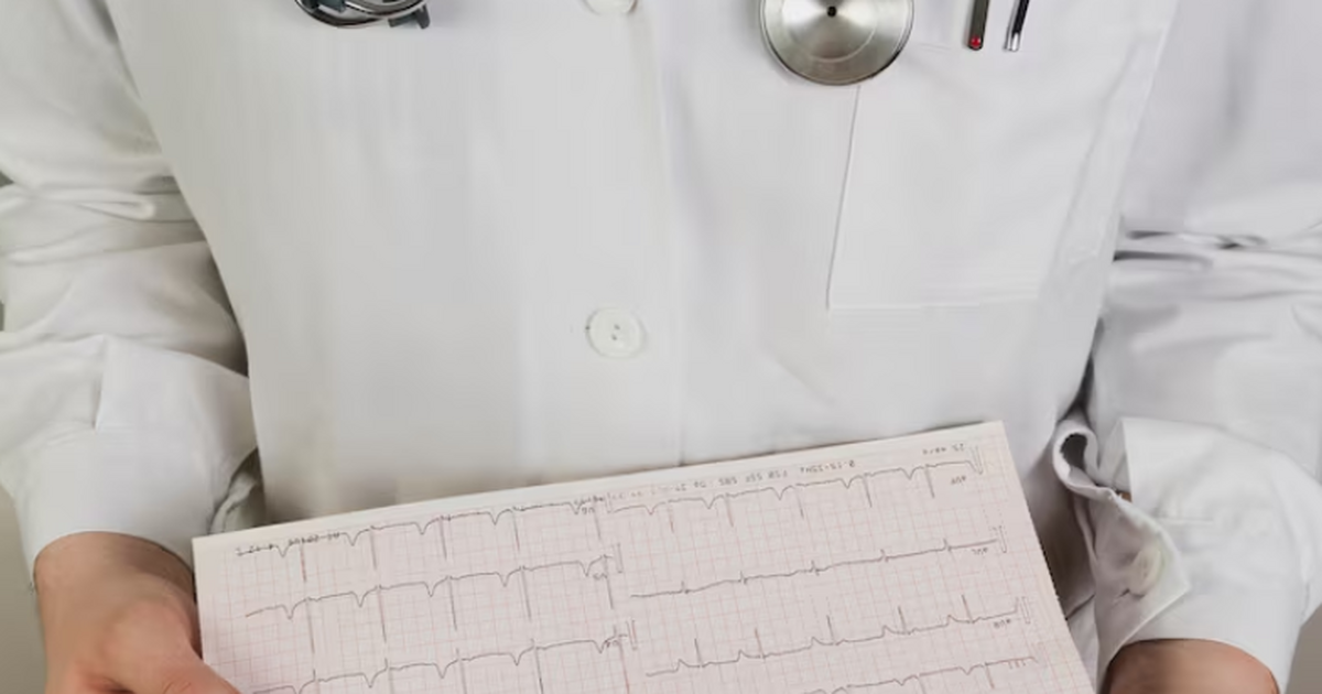 В Самарской области в 2025 году врачи спасли 54...