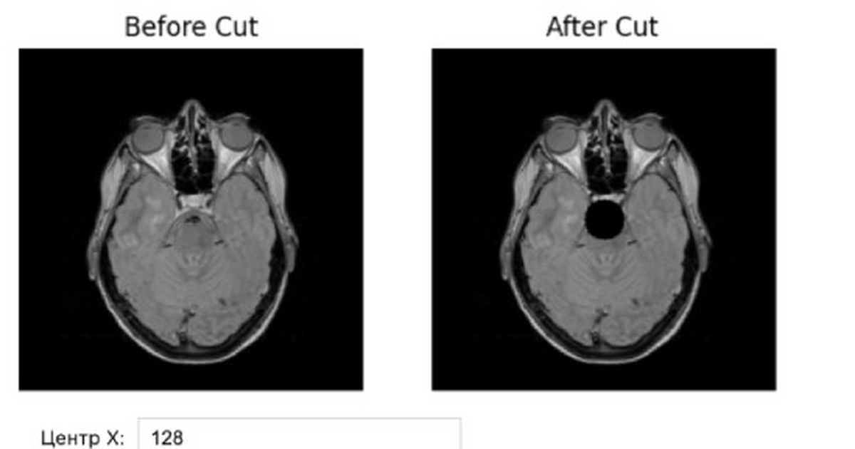 В Самарском политехе создали ИИ-платформу для синтетических МРТ-снимков Разработка уже используется для создания диагно...