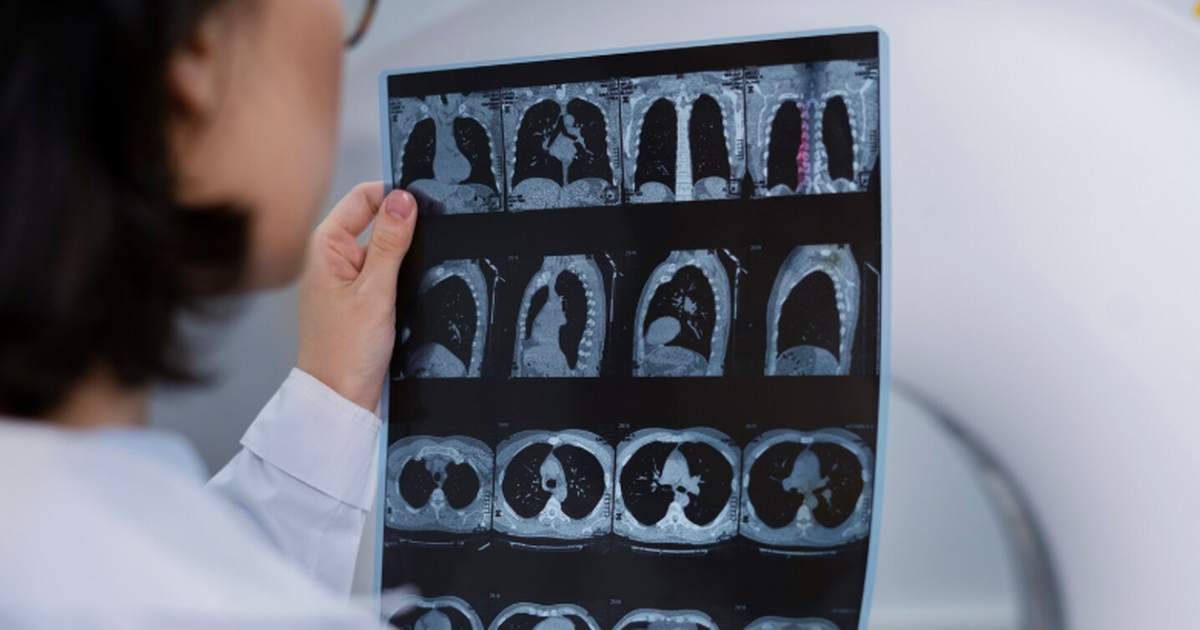 Исследование: задержка операции при раке груди повышает риск лишь слегка Онкологи центра Фокса Чейса оценили, как меняет...