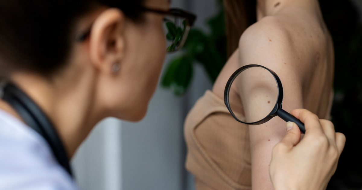 Использование соляриев почти втрое повышает рис...