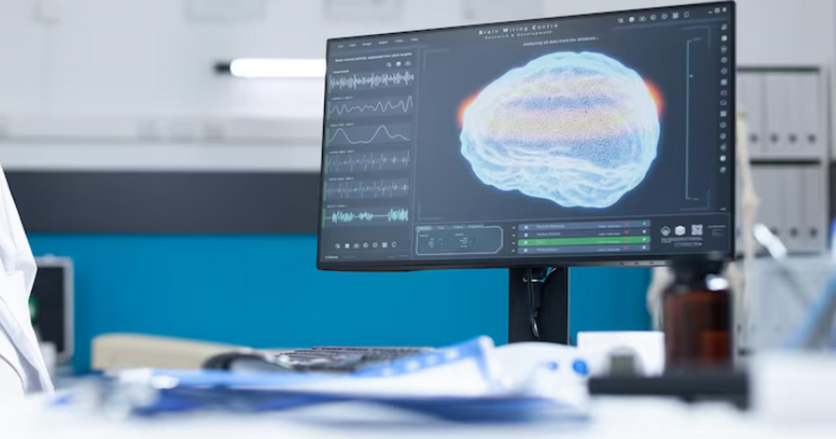 Учёные обнаружили участок островковой коры, акт...