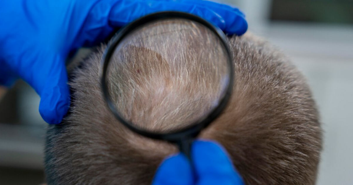 Клетки, которые заставляют волосы расти снова и...