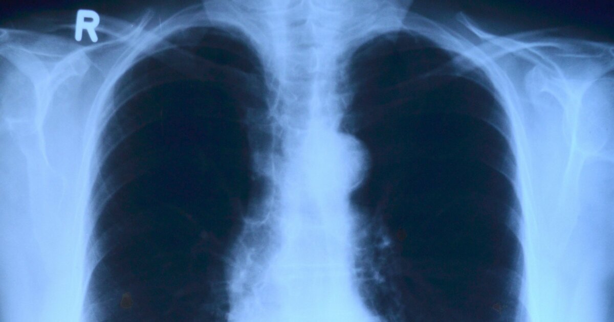 Подобные случаи могут быть связаны со снижением...