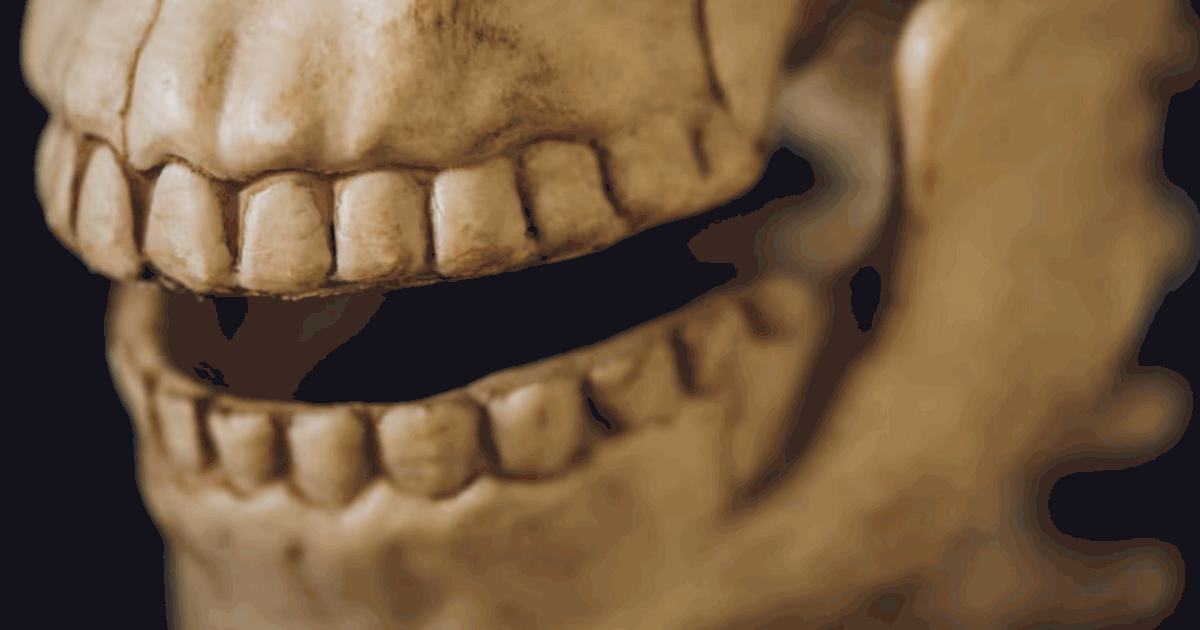 В Абердине нашли уникальный пример стоматологии...