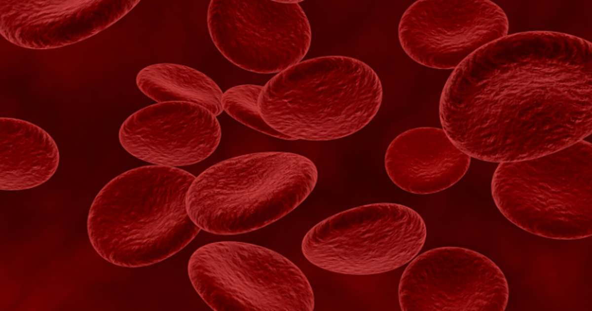 Атеросклероз, при котором в артериях формируютс...