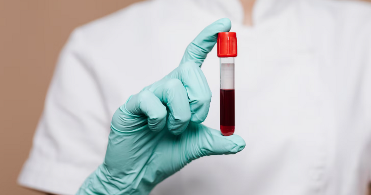 Остеопороз на ранней стадии можно выявить по показателям анализа крови Уровень фермента щелочной фосфатазы в крови мож...