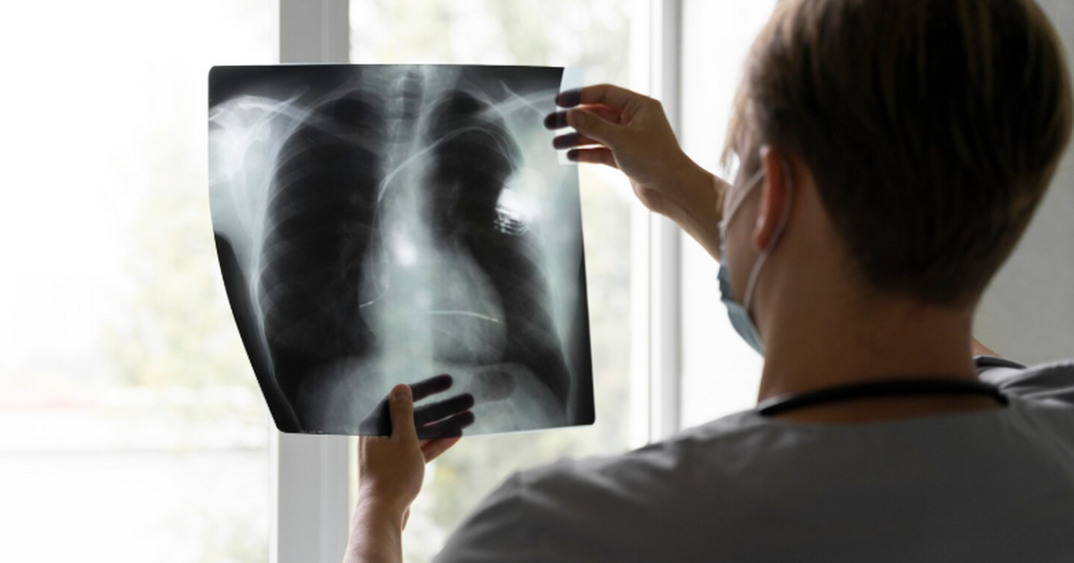 Американские медики впервые поддержали пациента...