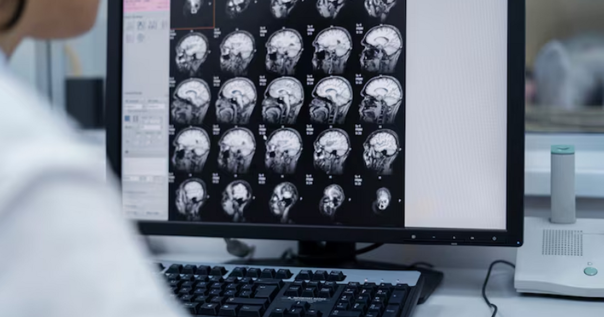 Житель Великобритании Даррен Харрис из Пейтона ...