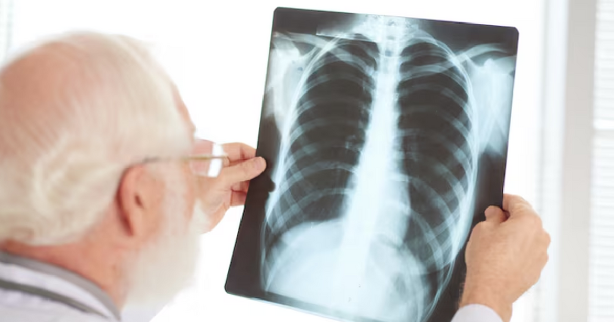 Томские ученые нашли способ прогнозировать распространение рака легких Ученые из Томска создали технологию, позволяющу...