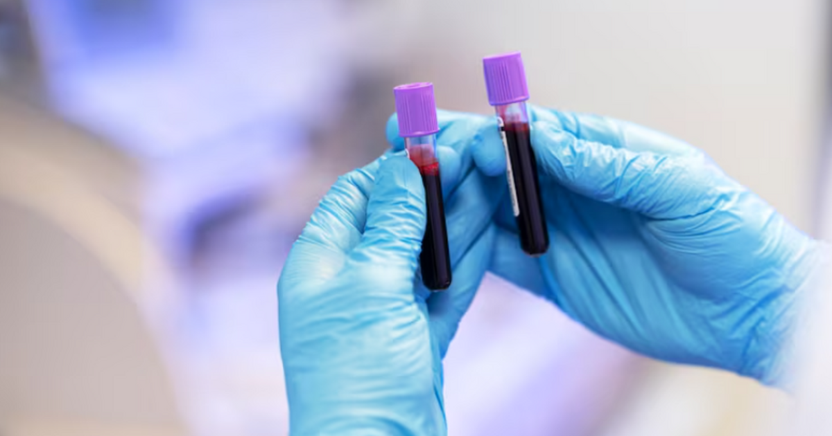 Ученые провели совместное исследование по управ...