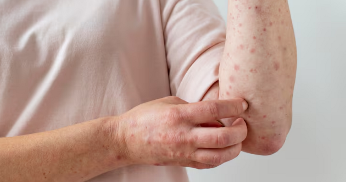 Кандидат медицинских наук Галина Компанец поясн...