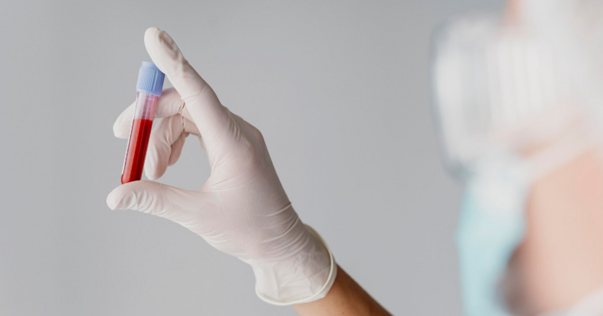 У людей с постковидным синдромом в крови выявил...