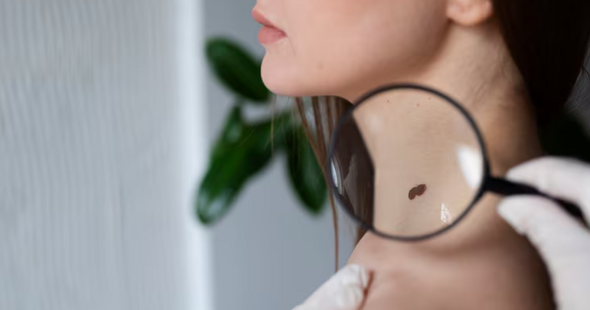 Биологи показали, что регулярный загар в соляри...