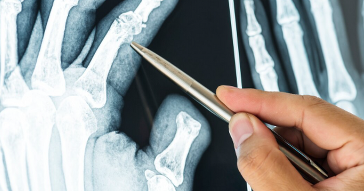 Исследование, опубликованное в журнале The Lanc...