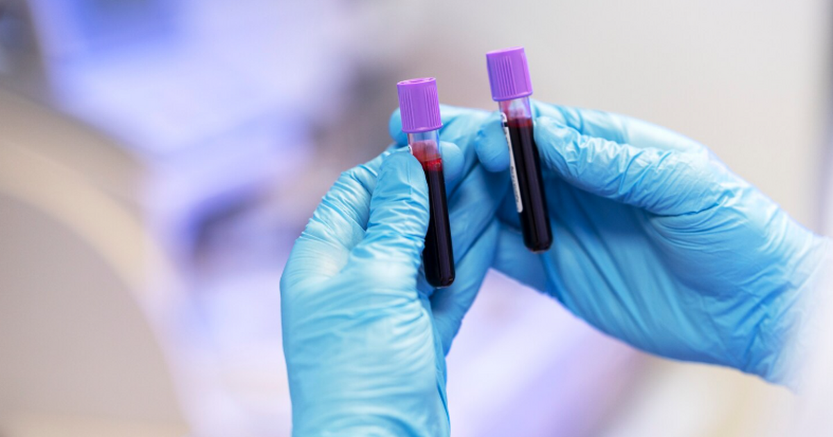 Исследователи разработали анализ крови с четырь...