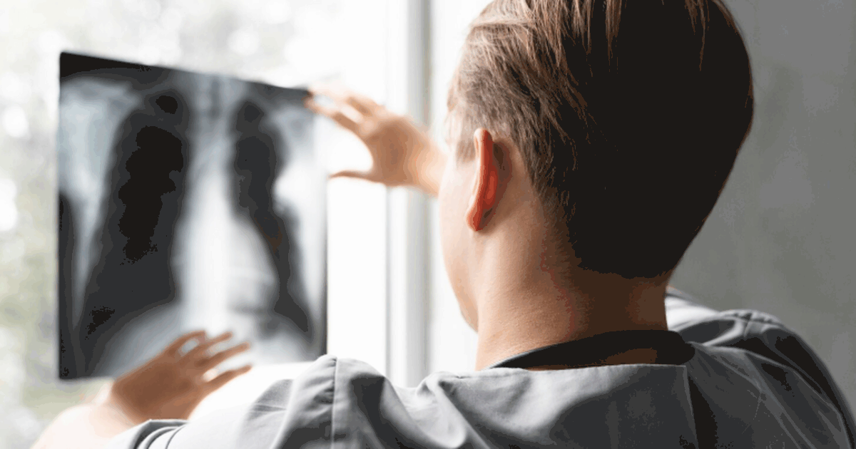 Врачи в России научились выявлять EVALI по новы...