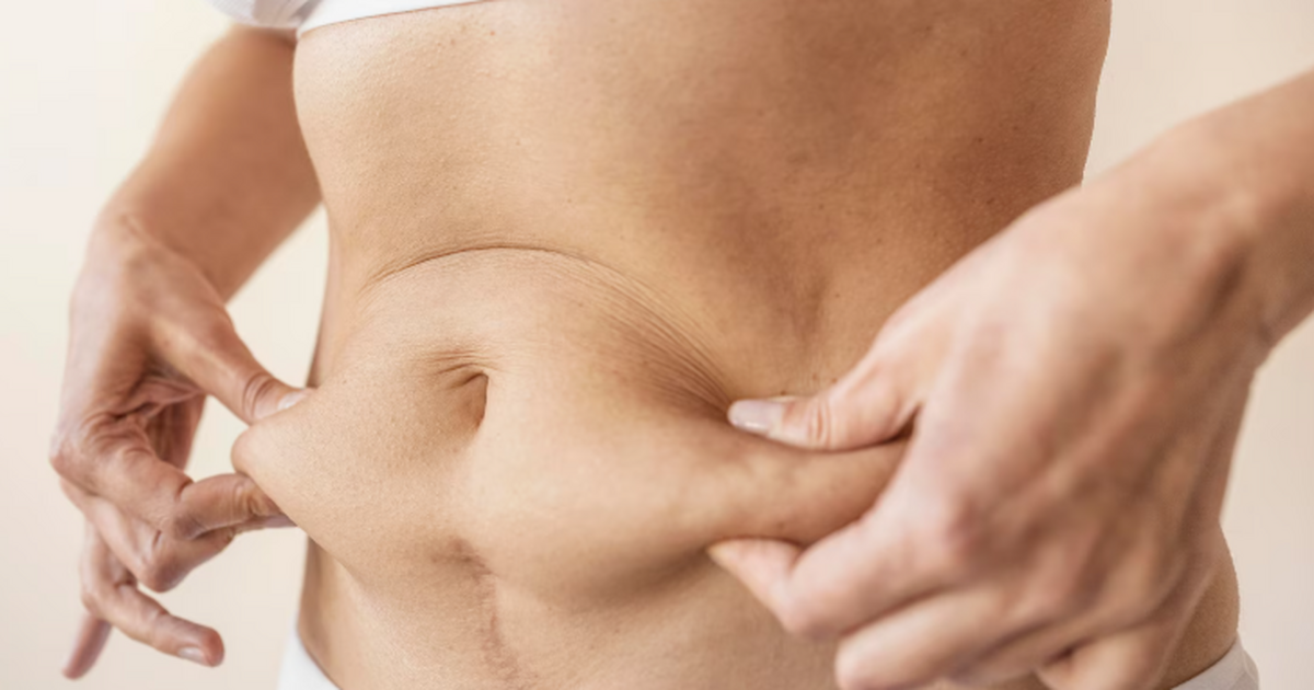 Сочетание жира на животе и низкой мышечной масс...