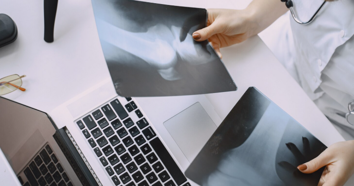 ПНИПУ: модель предсказывает «старение» углеродных имплантатов Ученые разработали первую в мире компьютерную м...