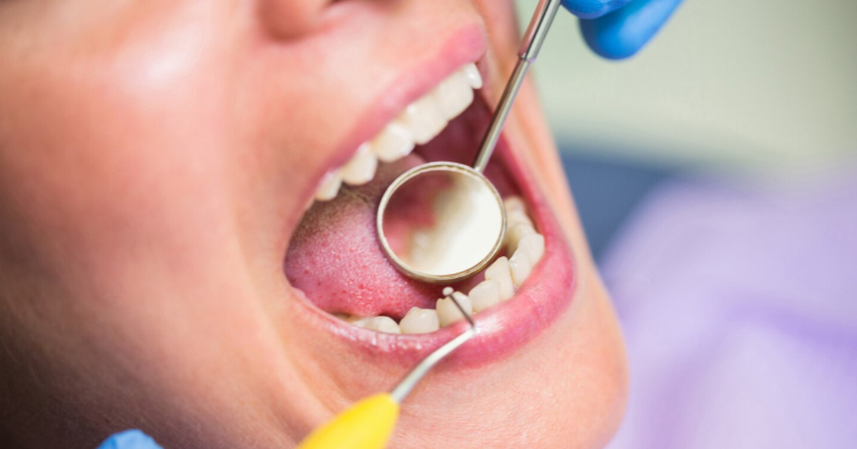 Учёные НИТУ МИСИС разработали гель‑декстраназу против кариеса Ученые предложили новый подход к профилактике к...