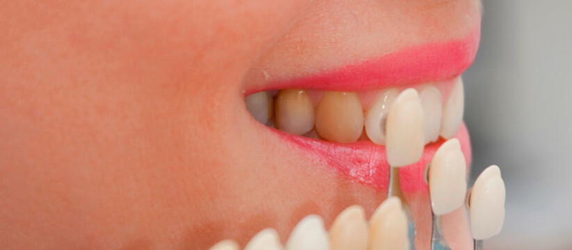 Счастливая улыбка без страданий: самарские ортопеды раскрывают секреты «голливудских» зубов