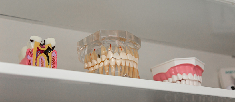 Разглаживание морщин с помощью имплантации: как самарские стоматологии за один день меняют человека